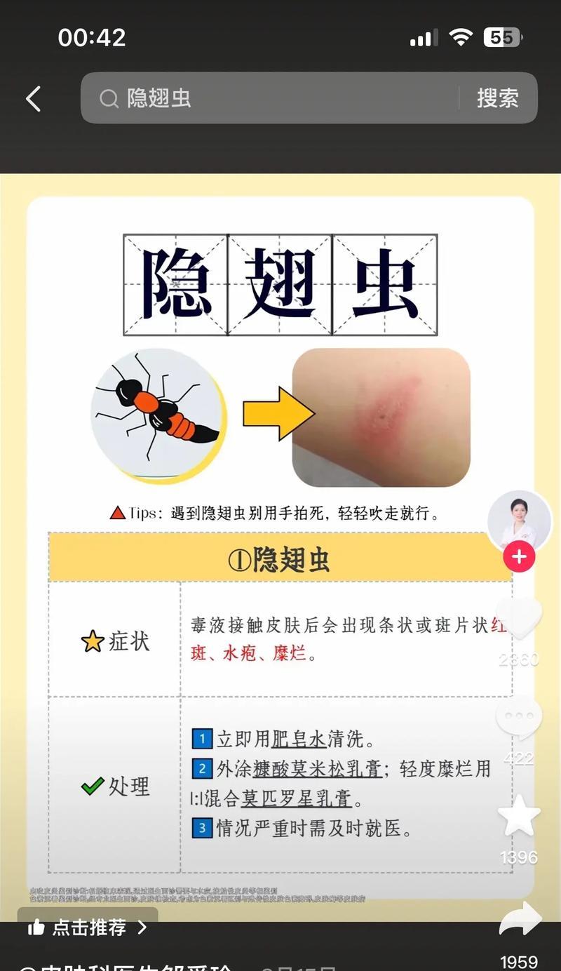 多肉被虫子咬了怎么办？（有效防治虫害，拯救你的多肉植物）
